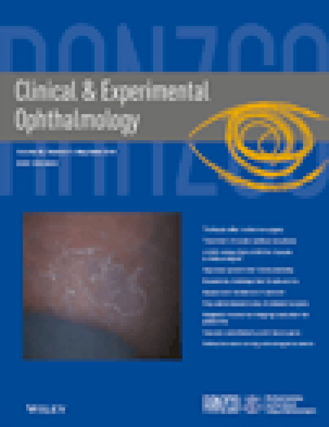 Laser-assisted subepithelial keratectomy versus epipolis laser in situ keratomileusis for myopia: a meta-analysis of clinical outcomes